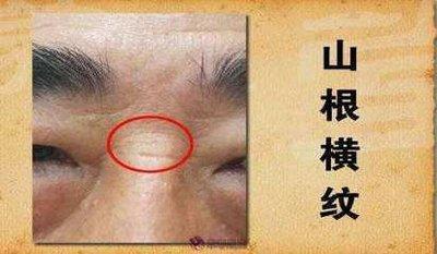 鼻梁有横纹面相好不好 鼻梁长有横纹好吗