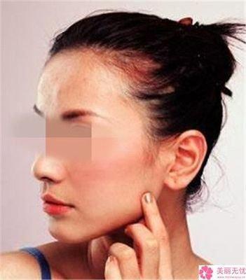 鼻梁歪象征着什么 鼻梁歪的人一生运势分析