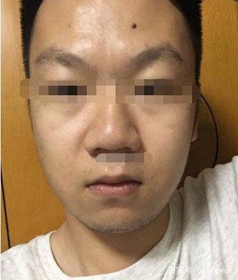 鼻梁骨塌面相分析 鼻梁塌的人命运好吗