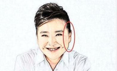 鼻翼有痣的人面相好不好 鼻翼长痣好吗
