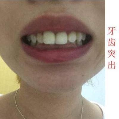 龅牙面相解析 龅牙对运势发展有影响吗