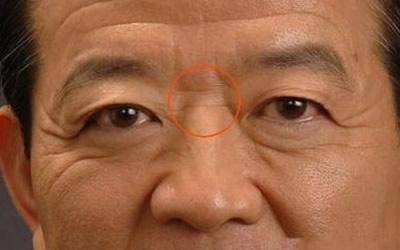 抬头纹的面相含义分析 长有抬头纹会有什么影响