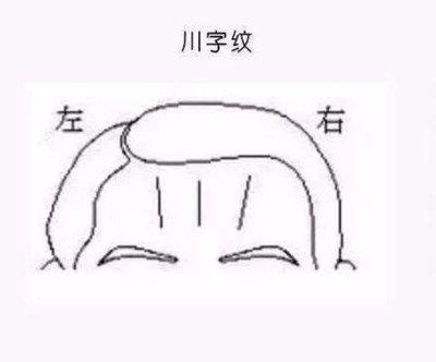 抬头纹纹路很深运气好吗 抬头纹深说明了什么