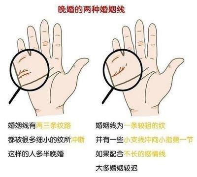 无名指上有痣好不好 无名指有痣代表什么