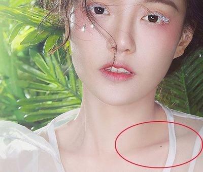 脖子长痣看运势 脖子上长痣了说明什么