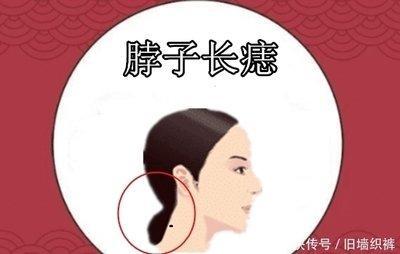 脖子长痣看运势 脖子长痣到底好不好