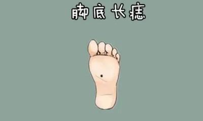 脚下有痣代表了什么 脚下有痣有什么意义