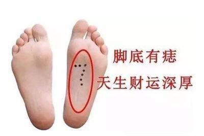 脚下有痣代表了什么 脚下有痣有什么意义