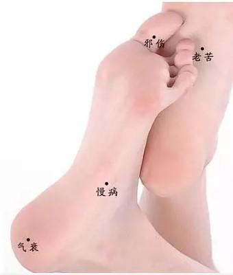 脚底长痣是什么意思 会带来哪些影响